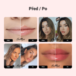 Alternative view of Zázvorová & Mátová BULKLIPS sada pro zvětšení rtů