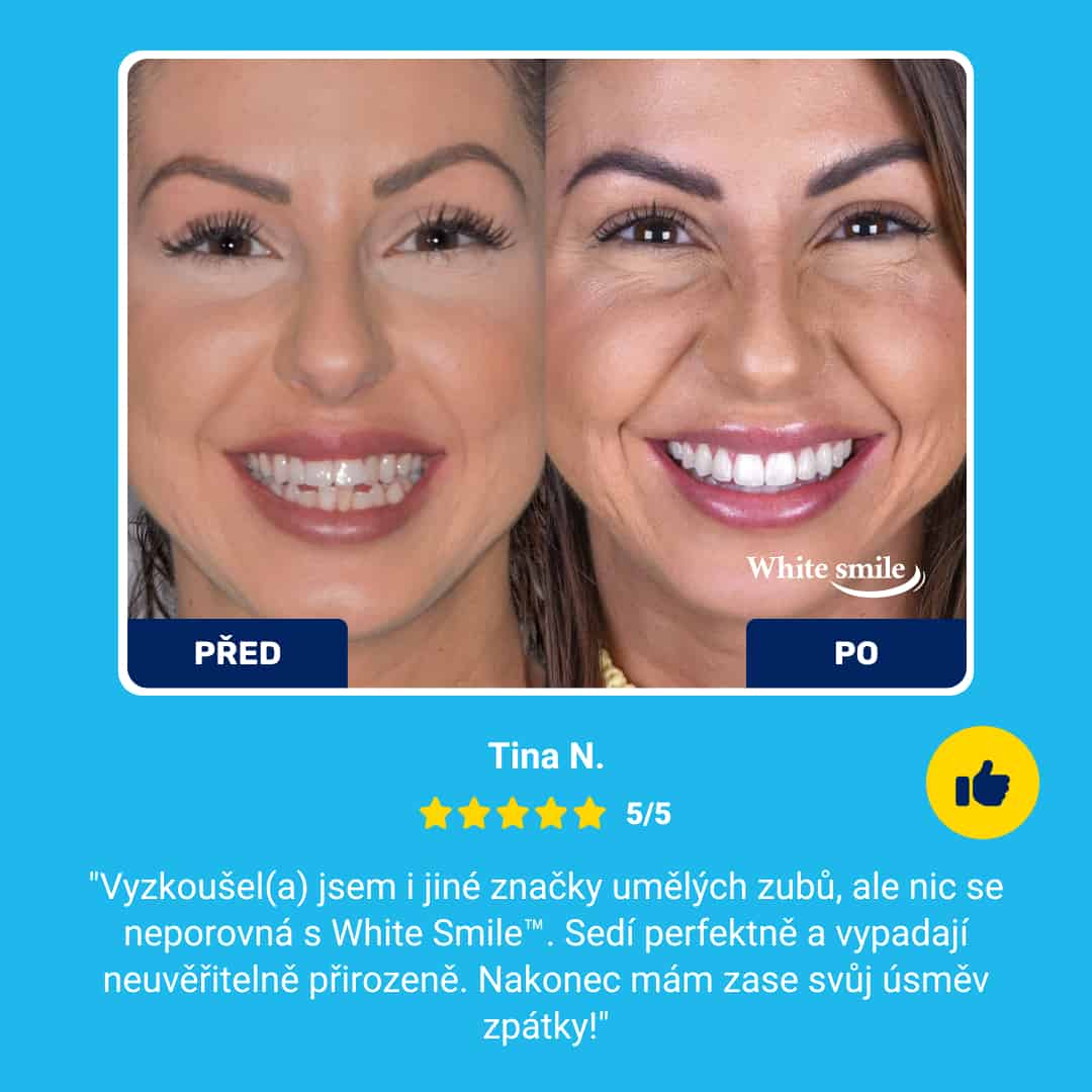 Realisticky vypadající falešné zuby: WhiteSmile - Obrázek 7