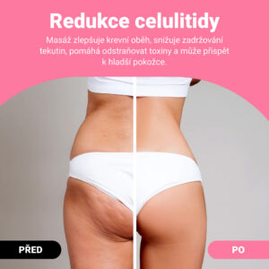 Alternative view of GUASHA – tvarující masážní váleček pro viditelné snížení celulitidy a tuku
